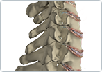 Cervical Spondylolysis