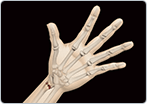 Distal Radius Fracture