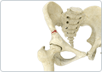 Fracture of the Pelvis