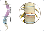 Fracture of the Thoracic and Lumbar Spine