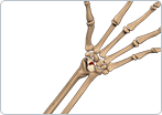 Scaphoid Fracture