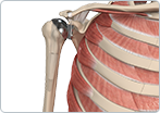 Shoulder Joint Replacement